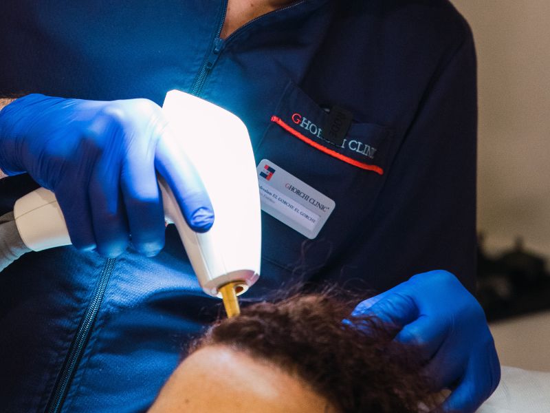 causas y cómo prevenir la caída del cabello