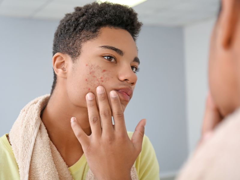 rutina para quitar granos de la cara