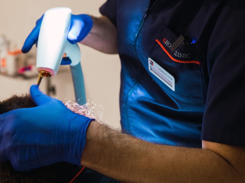optimizar la salud del cuero cabelludo