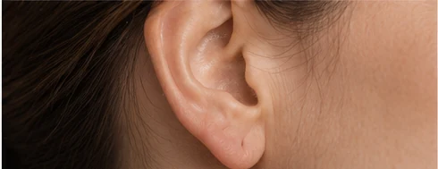 Lobuloplastia y reparación del lóbulo rasgado