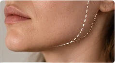 Volumen de la musculatura mandibular relacionado con el bruxismo